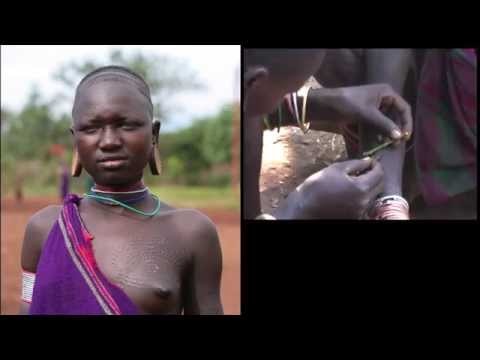 pourquoi la scarification