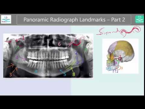 Panoramic Radiograph Landmarks Tutorial - Part 2