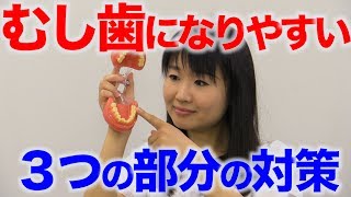 むし歯になりやすい場所は？