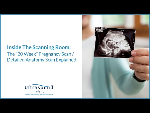 The 20-Week Anatomy Pregnancy Scan Explained | Ultrasound Ireland