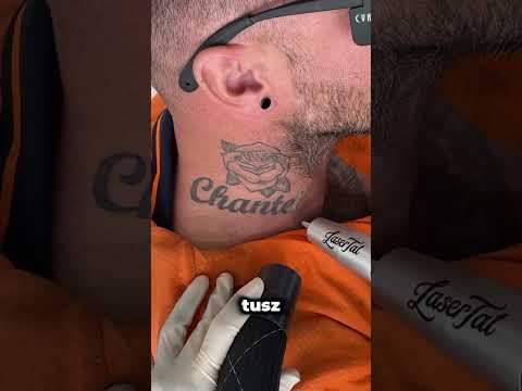 Jak blakną tatuaże