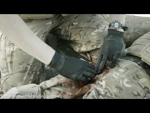 Гемостатичний бинт Celox RAPID Hemostatic Z-Fold Gauze кровоспинна пов'язка цетокс - фото 1 - id-p1660726083