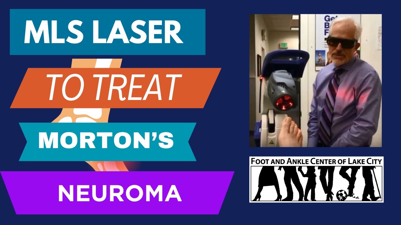 Using MLS laser to Treat Morton's Neuroma Foot and Ankle Center of