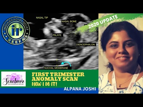 FIRST TRIMESTER ANOMALY SCAN | How I do it by Alpana Joshi | FETAL IMAGING | NASAL BONE & NT