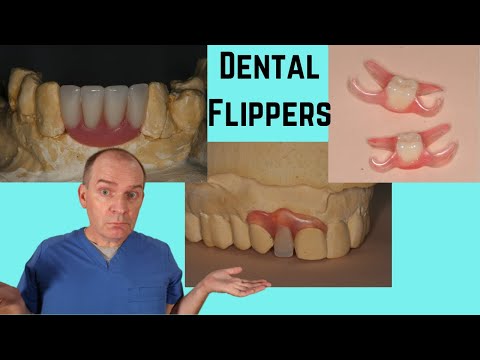 What is a dental flipper?