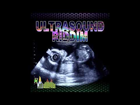 Kalado - Now Or Never (Explicit) [Ultrasound Riddim]