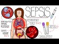 Understanding Sepsis Sepsis Explained Clearly