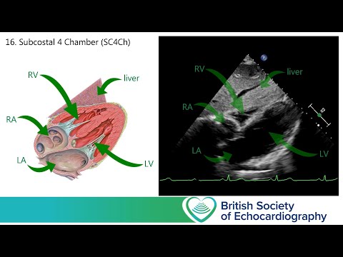 Level 1 - The Focused Echo