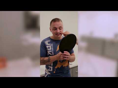 Smile Transformation in Istanbul | Real Patient Result | YEG Dental Clinic