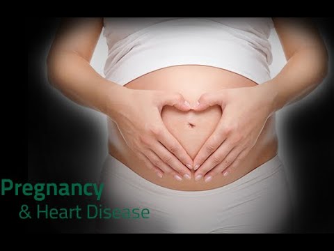 DU CPC Université de Paris Grossesse contraception et cardiopathies congénitales Dr Magalie Lado