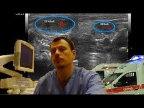 Pediatric Soft tissue ultrasound - thickening of the sternocleidomastoid muscle at neonate