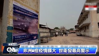 瑞典出現較危險M痘病毒株案例 非洲以外首見