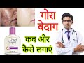 Lacto Calamine Face Lotion HONEST Review 2023 In Hindi Results Benefits Uses Price Info