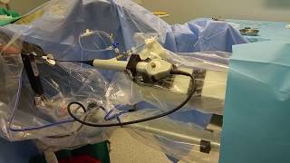 Avicenna Roboflex™ - robot do leczenie kamicy nerkowej