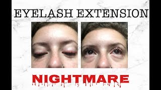 HOW TO DEAL WITH EYELASH EXTENSION IRRITATIONS