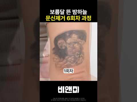 리얼후기-문신전후