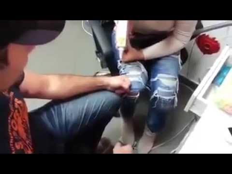 Uklanjanje tetovaze ND:YAG laserom Kozmeticki 2A Tuzla