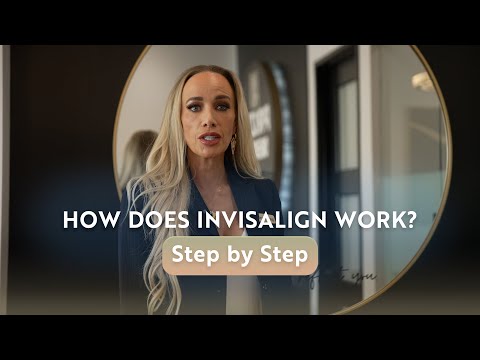 How Does Invisalign Work? Step-by-Step Guide to Clear Aligners