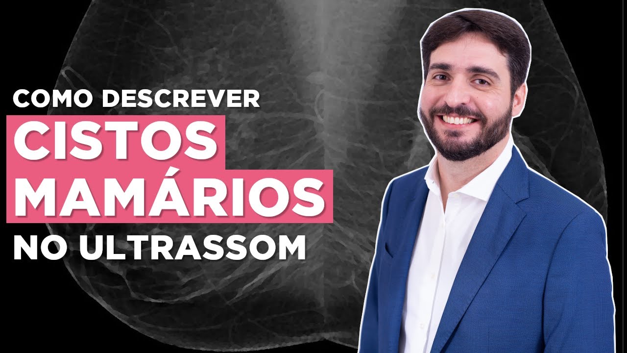 Tudo que você precisa saber sobre cistos mamários no ultrassom | Galvani Filho