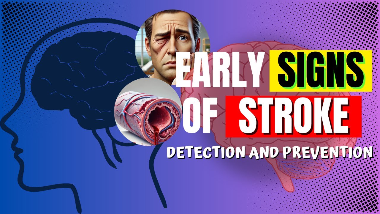 Early Signs of Stroke! How to Detect and Prevent!