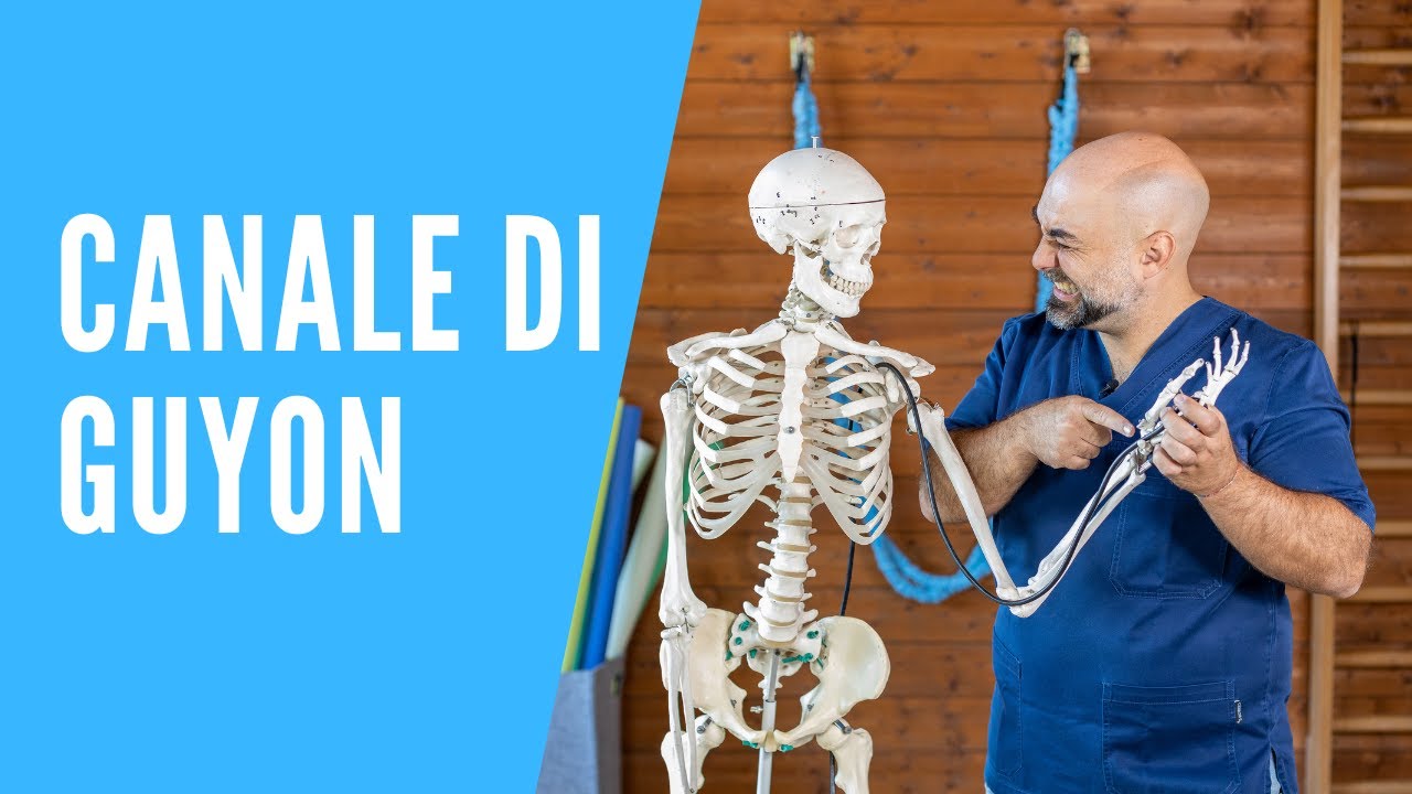 Watch Now Formicolio e dolore al mignolo la sindrome di Guyon! Consigli e rimedi! Formicolio e dolore al mignolo la sindrome di Guyon! Consigli e rimedi!