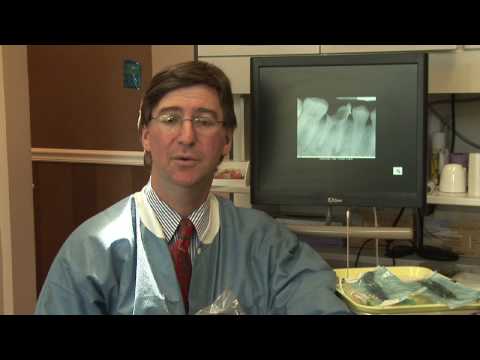 Tooth Abscess : How to Treat an Abscess With Home Remedies