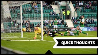 Hibs 1-3 Newcastle | Quick thoughts