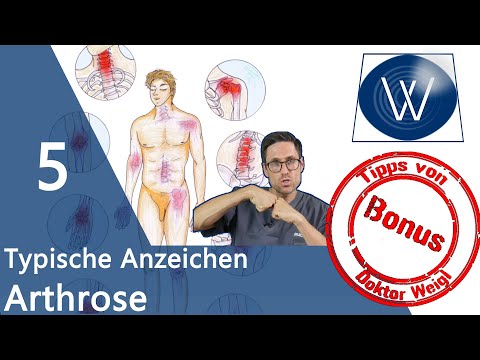 Arthrose-Lüge: 5 Anzeichen für Arthrose im Gelenk - diese Symptome & Tipps sollten Sie kennen ⚠️