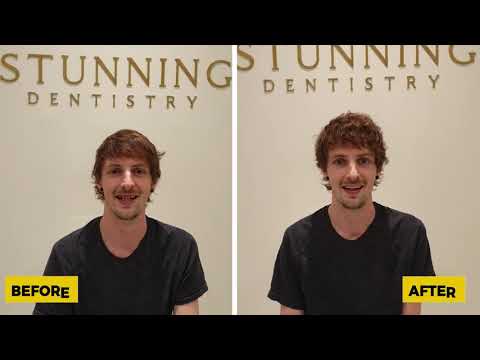 Luxury Dental Experience - Mr. Chris Russell from Australia at Stunning Dentistry, New Delhi