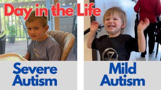 A Day in the Life of Mild Autism and Severe Autism