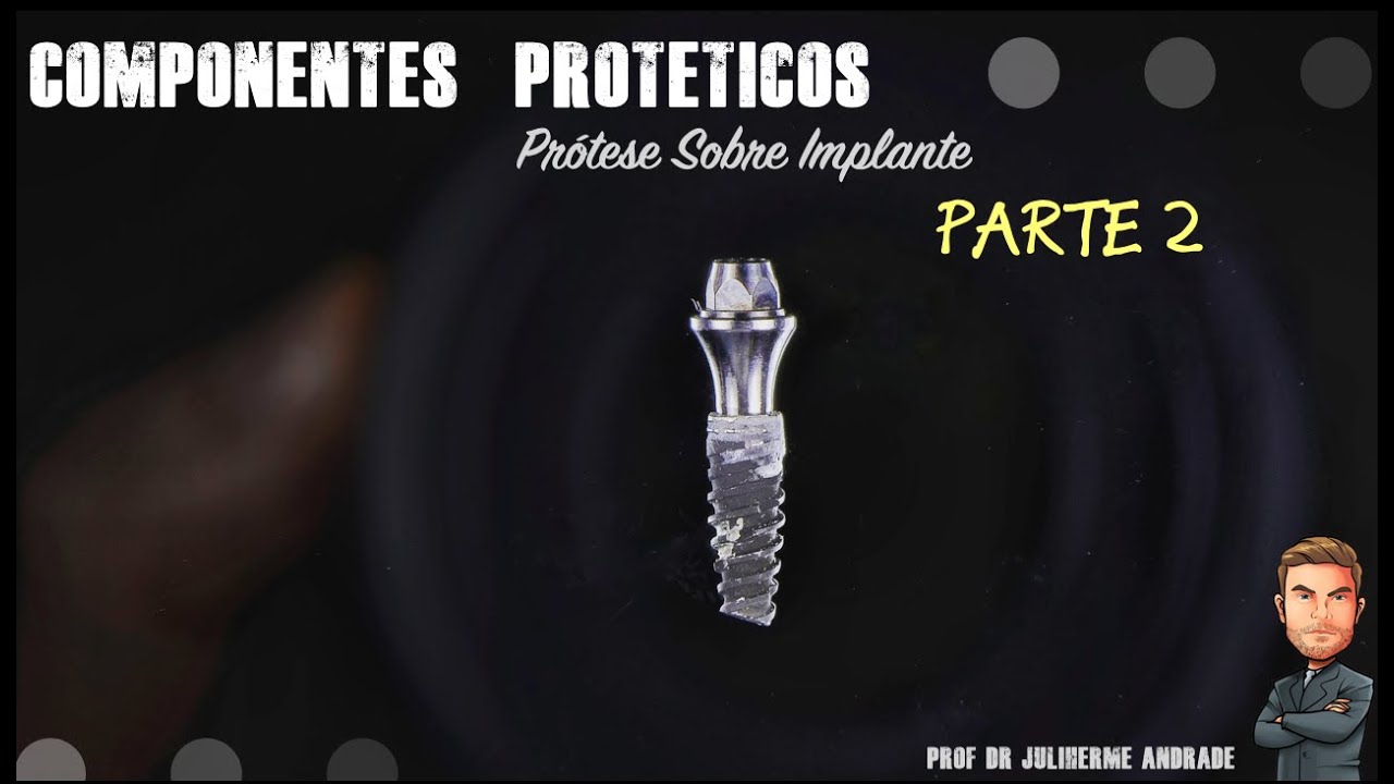 Seleção de Componentes Protéticos - Parte 2