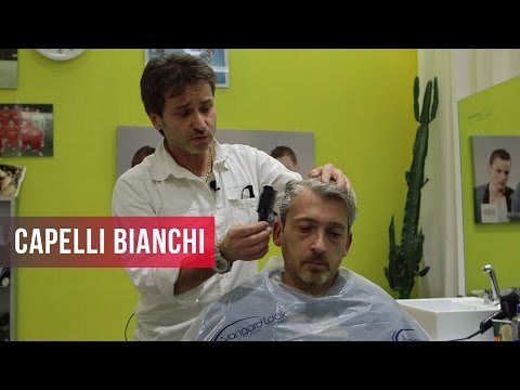 Cavie di lentiggine in Krasnodar Il pigmentary nota su pelle