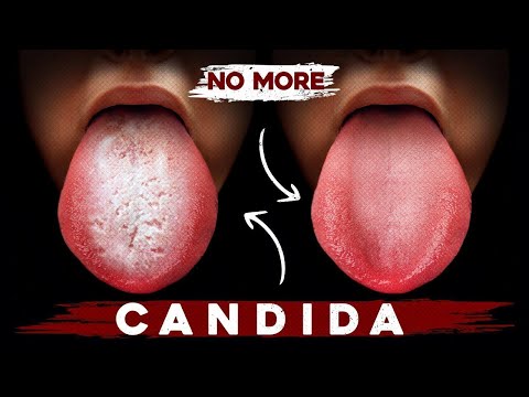 A Better Way to Eliminate Candida for Good