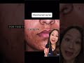 Treat Acne Like a Dermatologist #shorts