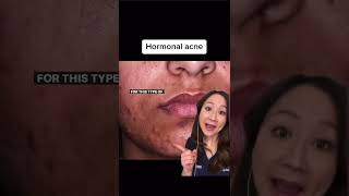 Download lagu Treat Acne Like a Dermatologist #shorts mp3