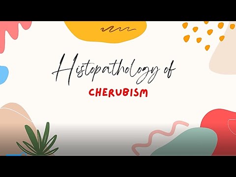 FUN WITH HISTOPATHOLOGY: # 33 CHERUBISM