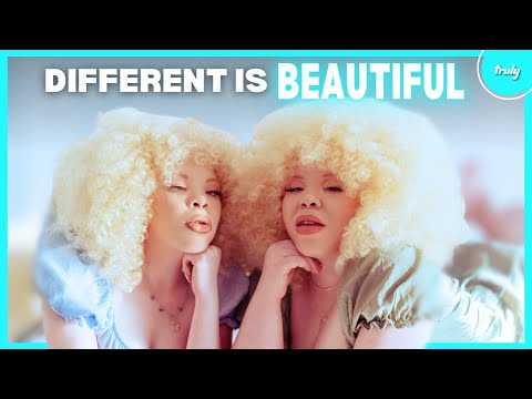 Born To Stand Out: Albinism | BORN DIFFERENT