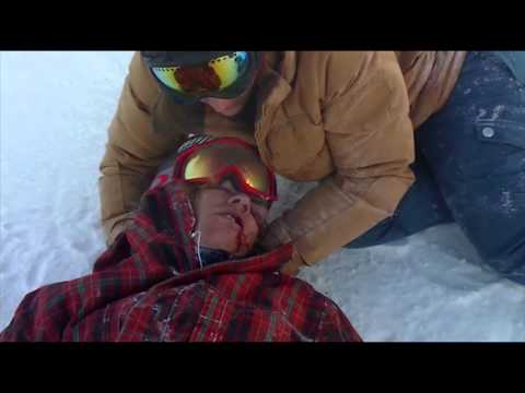 Kevin Pearce almost died in superpipe crash (Viewer Discretion Is Advised)
