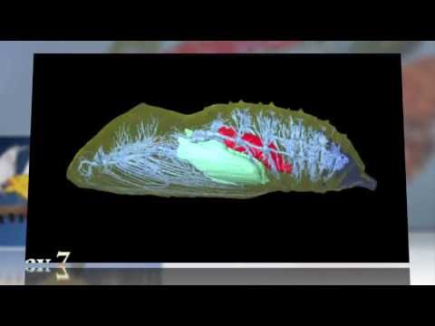 image-What animal goes through complete metamorphosis?