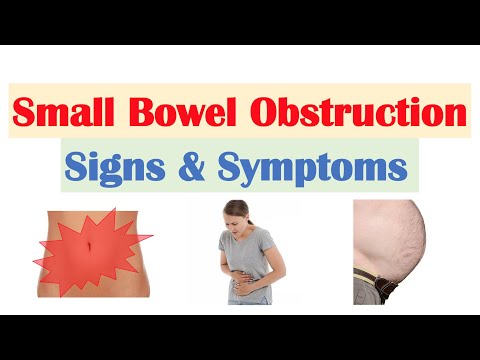 Small Bowel Obstruction (SBO) Signs & Symptoms, & Why They Occur