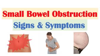 Small Bowel Obstruction (SBO) Signs & Symptoms, & Why They Occur