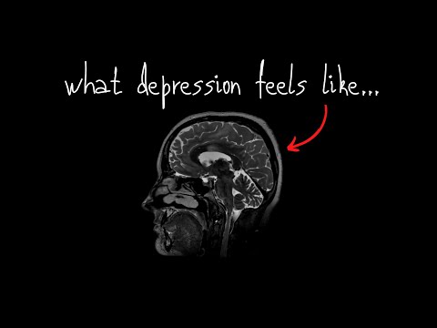 This Is What Depression Feels Like - Marina Lin