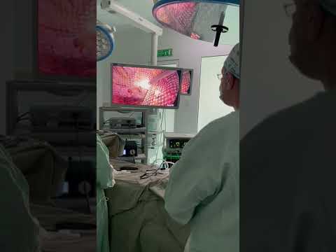 Dr. Carlos Luis Quin cirugía laparoscópica avanzada, cirugía bariátrica Barranquilla