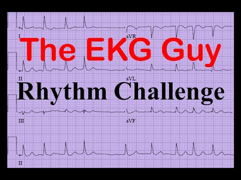 EKG/ECG - Rhythm Challenge 7.0 | The EKG Guy