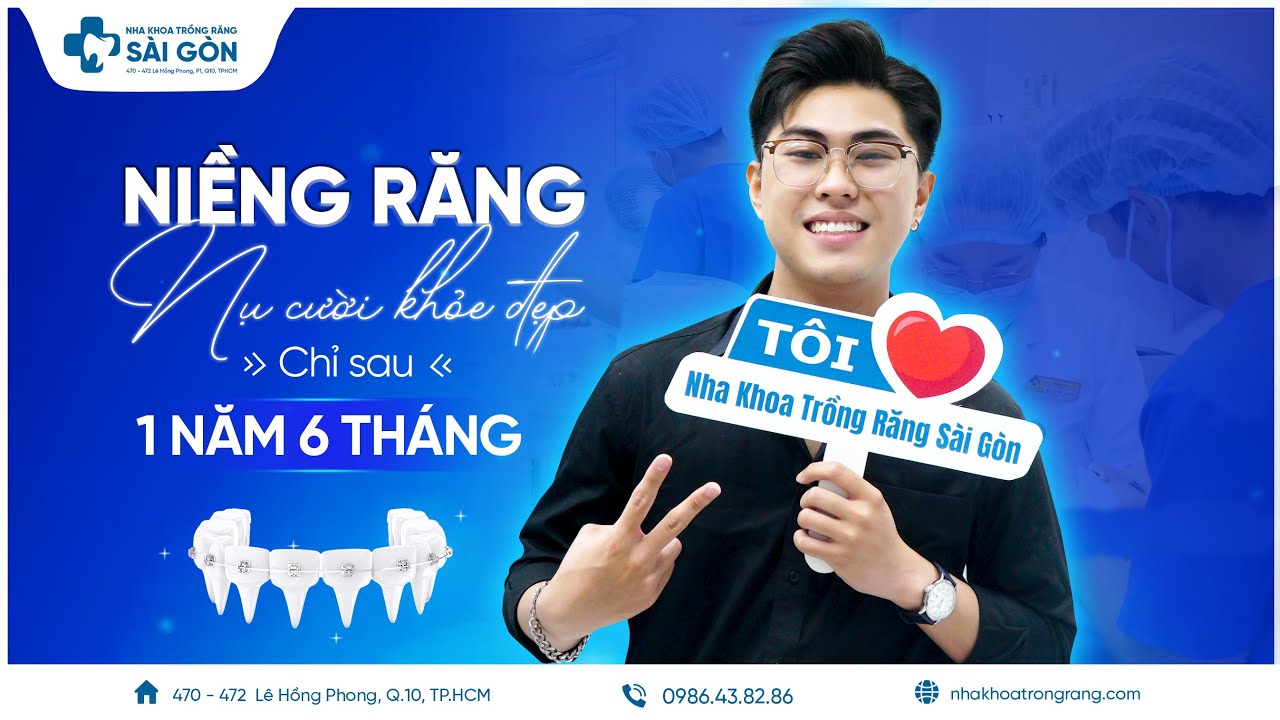 Tạm biệt nụ cười khấp khểnh chỉ sau 1 năm 6 tháng niềng răng | khách hàng ngọc hưng