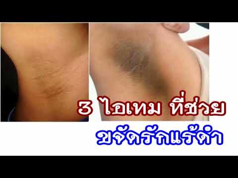 วิธีการที่โรคสะเก็ดเงินวิดีโอ กำมะถันสำหรับการรักษาโรคสะเก็ดเงิน