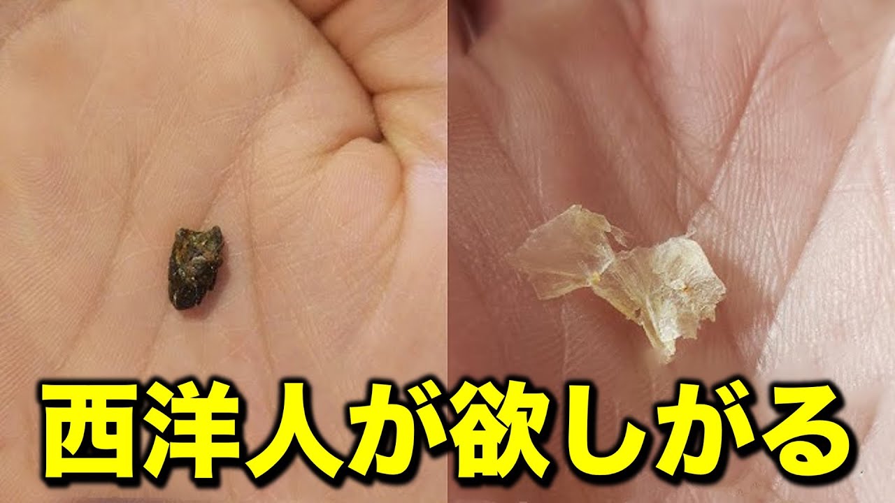 多くの東洋人が持つありがたい遺伝子！ 私にもある？