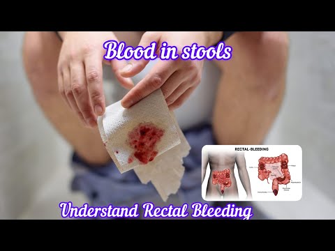 Blood in stools I Understand Causes and Tests to Diagnose @DrAshishSachan