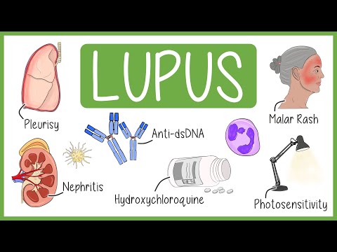 Systemic Lupus Erythematosus in 3 Minutes