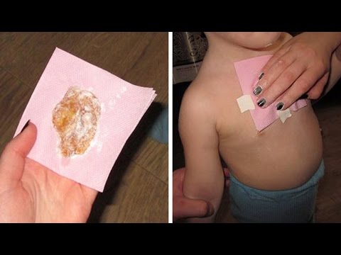 Wie Rückenschmerzen bei Frauen zu verhindern Geheimnisse golden in den Gelenken Whisker Schmerzen und von Salzen